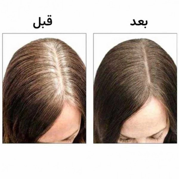 استیک پوشاننده موهای سفید گلدن رز